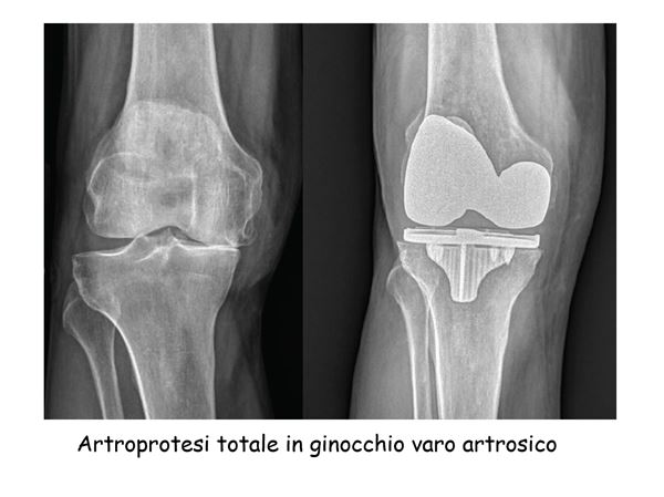Ortopedia e Traumatologia